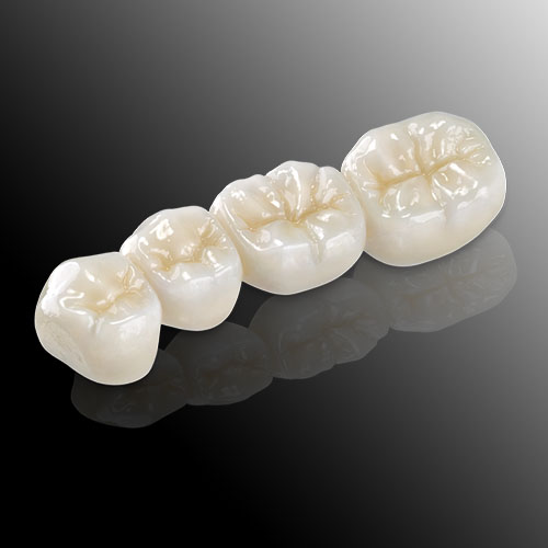 Sứ Cercon