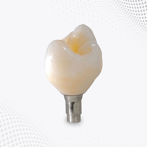Phục hình sứ trên Implant