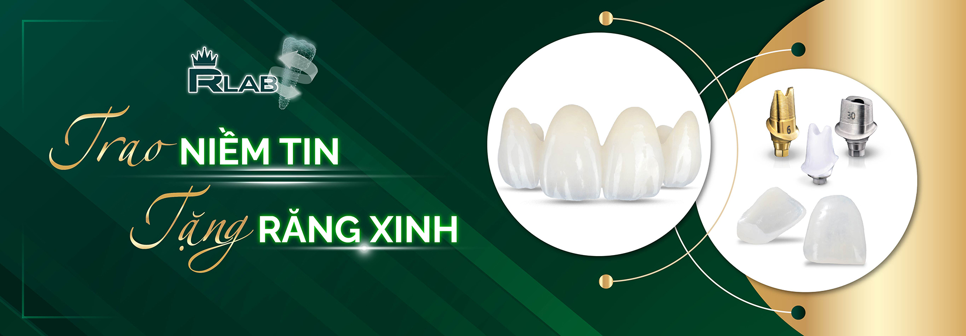 Trao niềm tin tặng răng xinh